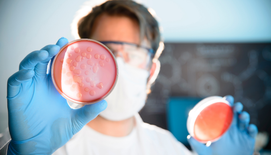 Control de calidad en ensayos microbiológicos