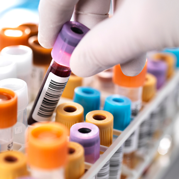 Legionella spp según la Norma UNE-EN ISO 11731:2017