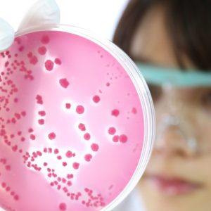 Validación y cálculo de incertidumbre en ensayos microbiológicos