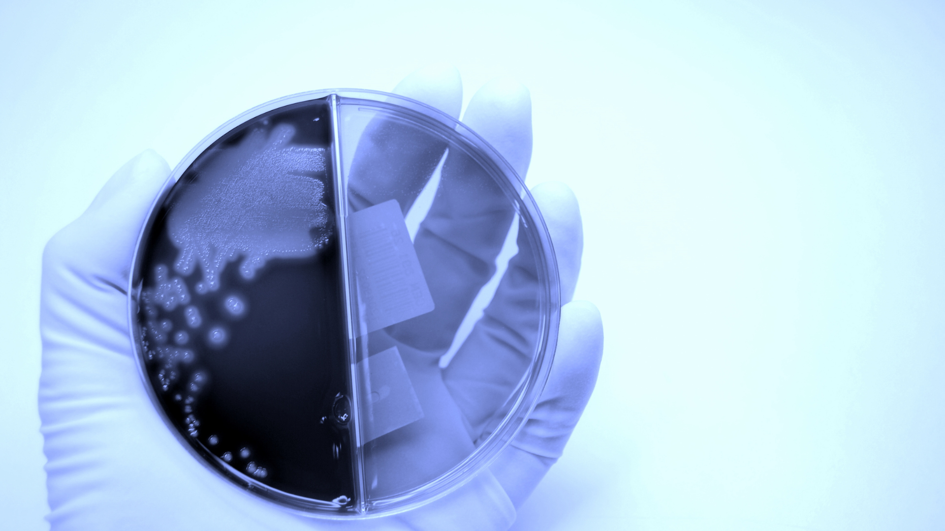 Control de la contaminación en microbiología